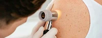 Dermatologia Cancer de Piel
